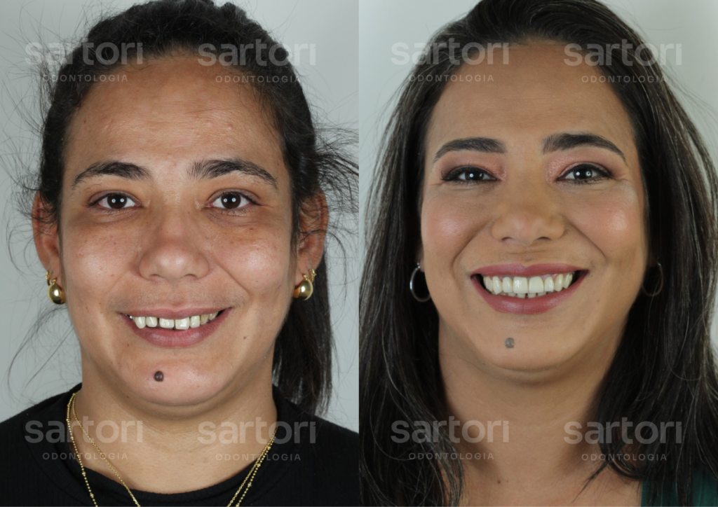 10 - ANTES E DEPOIS - 18.09