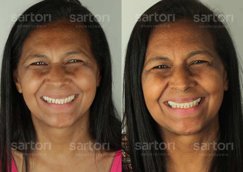 11 - ANTES E DEPOIS - 18.09