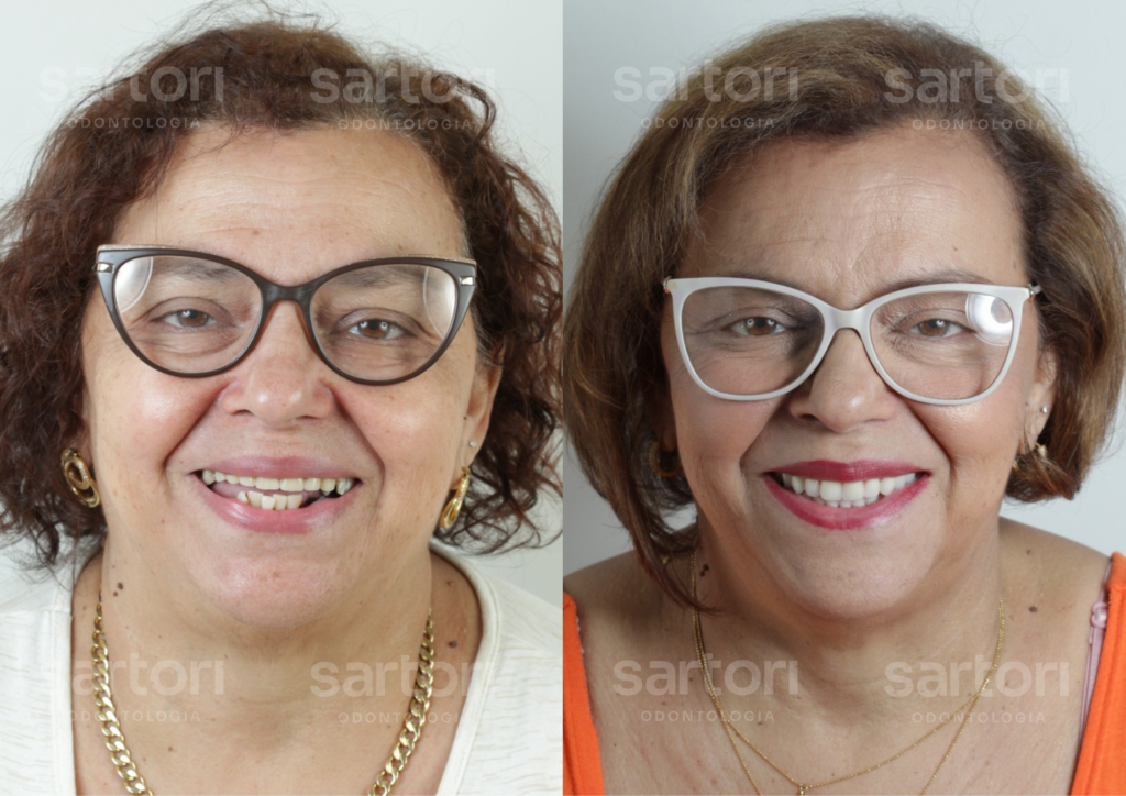 12 - ANTES E DEPOIS - 18.09