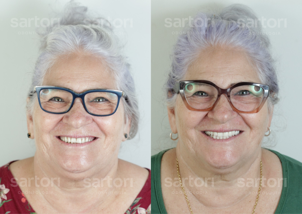 16 - ANTES E DEPOIS - 18.09