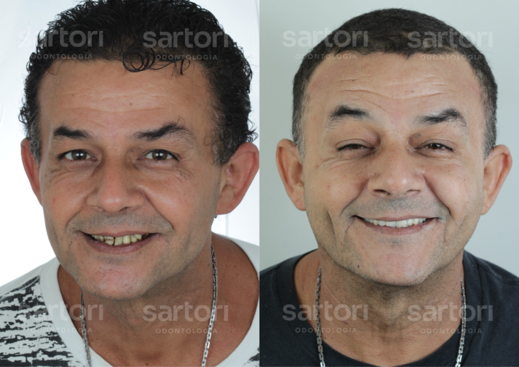 6 - ANTES E DEPOIS - 18.09