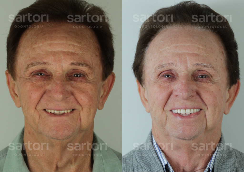 7 - ANTES E DEPOIS - 18.09