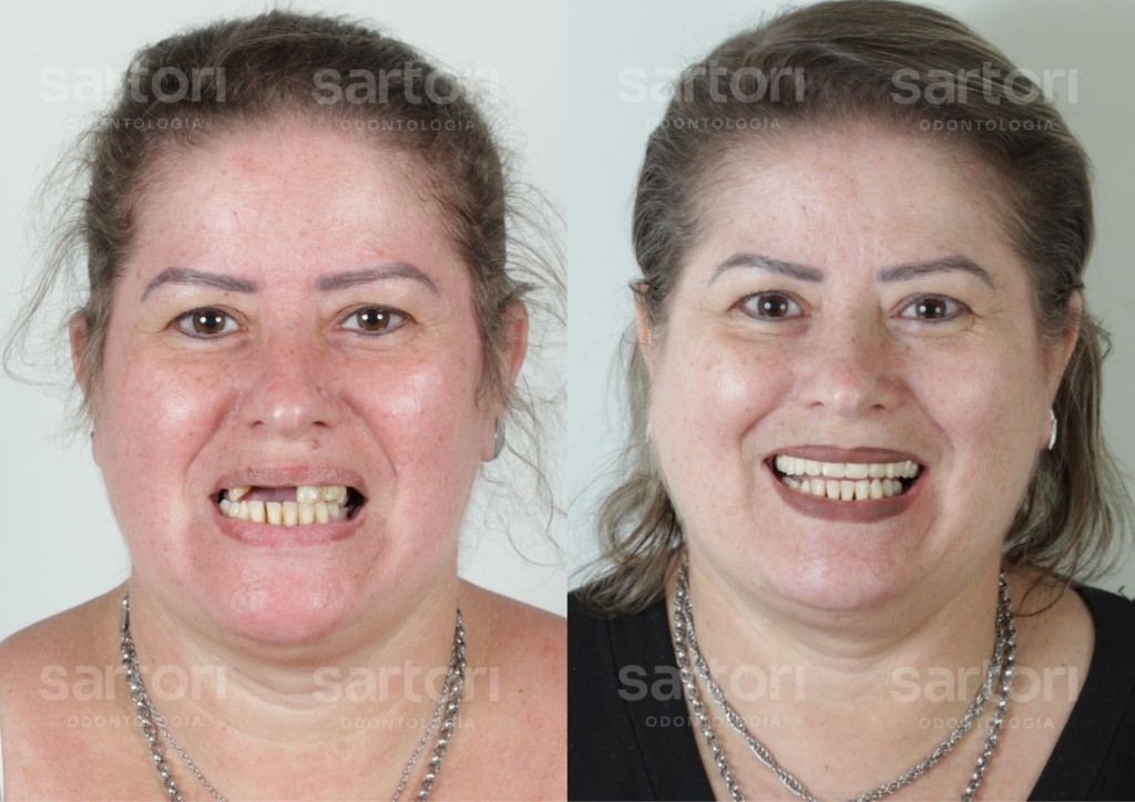 8 - ANTES E DEPOIS - 18.09