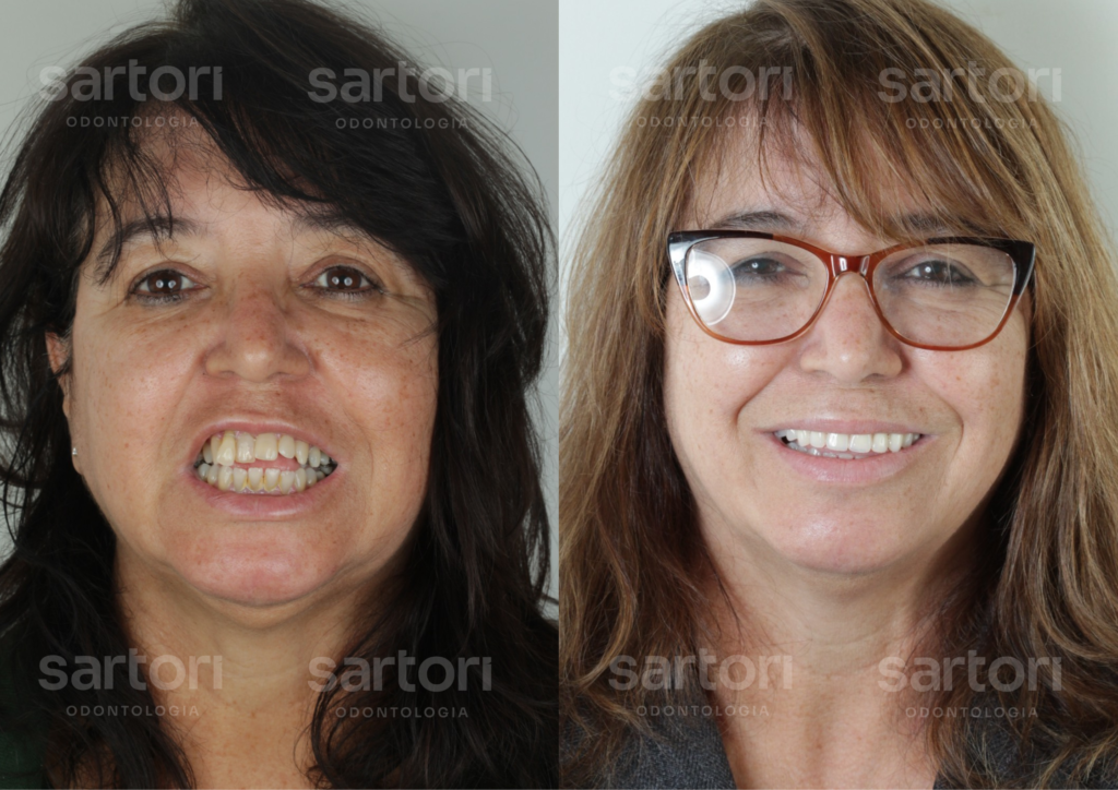 9 - ANTES E DEPOIS - 18.09